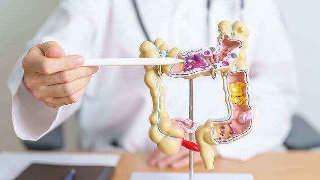 5 Lebensmittel zerst&ouml;ren wahrscheinlich den Darm - Forscher warnen
