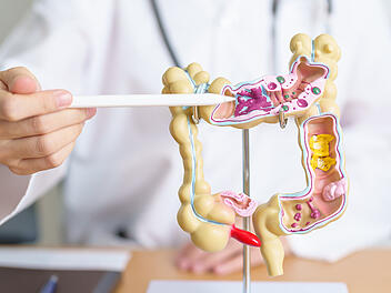 5 Lebensmittel zerst&ouml;ren wahrscheinlich den Darm - Forscher warnen