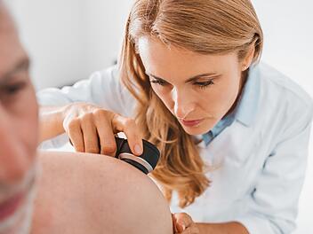 Ein Dermatologe untersucht die Haut eines Patienten. Dermatoskopie, Prävention von Melanomen, Hautkrebs.