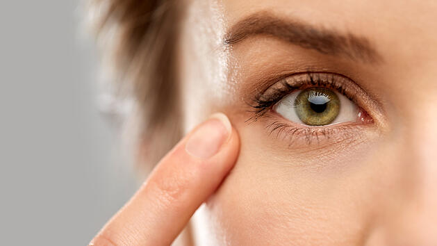 Erhöhtes Cholesterin an den Augen erkennen: Das sind die Anzeichen