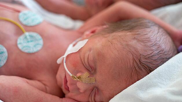 Klinikum W&uuml;rzburg informiert &uuml;ber Versorgung von Fr&uuml;hgeborenen