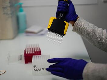 Eine Medizintechnikerin bereitet Proben von Corona-Viren vor, um zu prüfen, ob es sich bei ihnen um eine hochansteckende Corona-Mutation handelt. Auch im Landkreis Lichtenfels wurde bereits die erste Probe von einem Speziallabor geprüft. Foto: Daniel Cole/AP/dpa