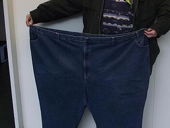 Ein im Klinikum Forchheim behandelter Patient zeigt die Hose, in die er einst passte, bevor es ihm gelang, 100 Kilogramm abzunehmen. Foto: Klinikum Forchheim