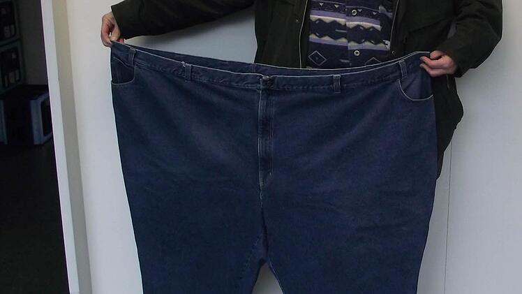 Ein im Klinikum Forchheim behandelter Patient zeigt die Hose, in die er einst passte, bevor es ihm gelang, 100 Kilogramm abzunehmen. Foto: Klinikum Forchheim