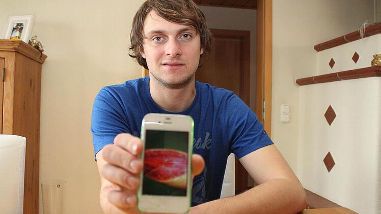 Auf seinem iPhone hat Kai Stöcker Fotos von seinen schweren Verletzungen gespeichert. Fotos: Sebastian Martin