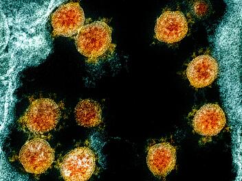 Mikroskopische Aufnahme des Coronavirus