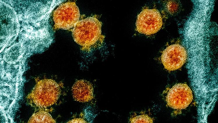 Mikroskopische Aufnahme des Coronavirus