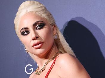 Lady Gaga musste ein Konzert kurzfristig absagen.