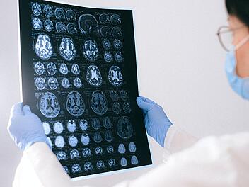 Neue Nahtod-Studie verblüfft: Das passiert mit dem Gehirn, wenn wir sterben