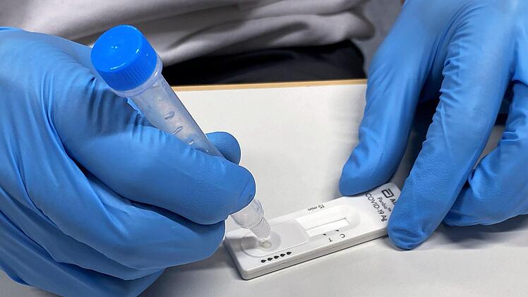 Die Lösung mit dem Abstrich wird auf einen Testträger getropft. Nach einigen Minuten ist dann das Ergebnis abzulesen.