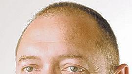 Standpunkt: Das Ende der Bescheidenheit