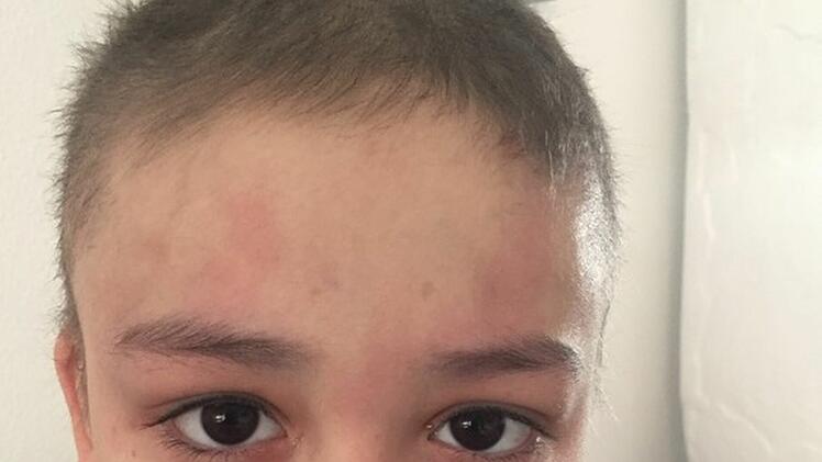 Nürnberg: Aurelia (6) kämpft gegen Krebs - "Bitte, lieber Gott, lass es gut ausgehen"