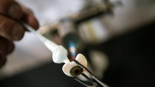 Eine Gesichtsprothese verhalf Denise Vicentin nach langem Krebsleiden zu neuer Lebensfreude. Symbolfoto: Andreas Arnold/dpa