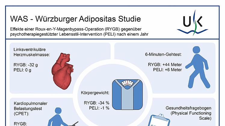 Würzburg: Magenbypass bei starkem Übergewicht - Uniklinik beweist erstmals die positiven Effekte
