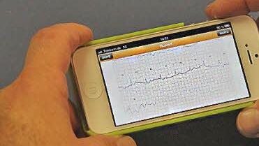 Das Handy zeichnet auf, erzeugt eine Grafik, die auch sofort analysiert wird. Die Daten lassen sich per Mail an den Arzt schicken.