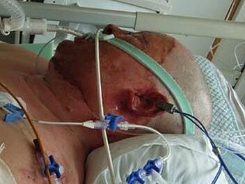 Gisela Lang weiß, dass ihr in der Klinik das Leben gerettet wurde. Dennoch graut es ihr davor, wieder in Behandlung gehen zu müssen. Foto: privat