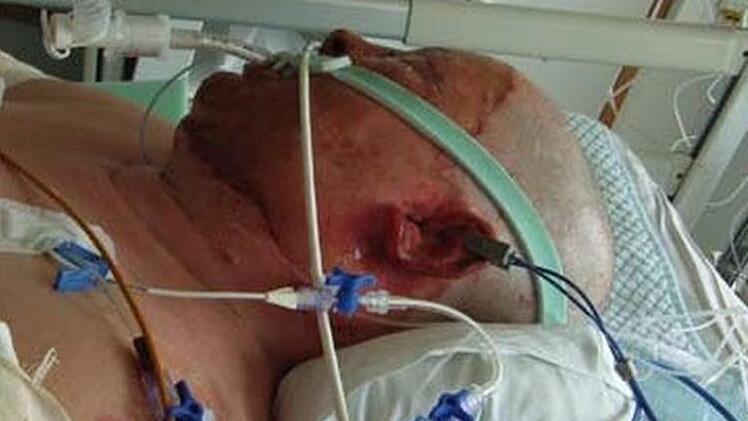 Gisela Lang weiß, dass ihr in der Klinik das Leben gerettet wurde. Dennoch graut es ihr davor, wieder in Behandlung gehen zu müssen. Foto: privat