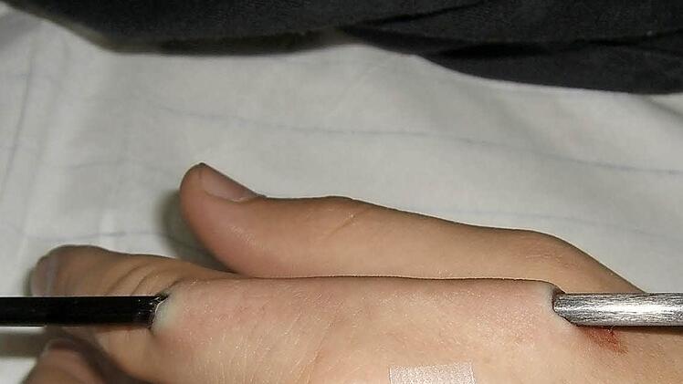 Die Klinik hat die Verletzung damals auf einem Foto dokumentiert.Foto: Archiv