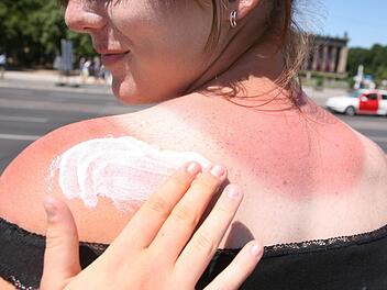 Eine Frau bekommt den Sonnenbrand mit Sonnencreme eingecremt. Mit der Sonne kommt auch die Sonnenbrandgefahr. Foto: Stephanie Pilick/dpa
