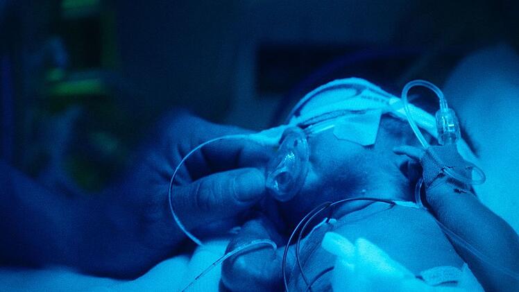 Ein künstlicher Uterus könnte in Zukunft nicht nur Babys außerhalb des menschlichen Körpers heranreifen lassen. Er könnte ebenso Frühchen retten.