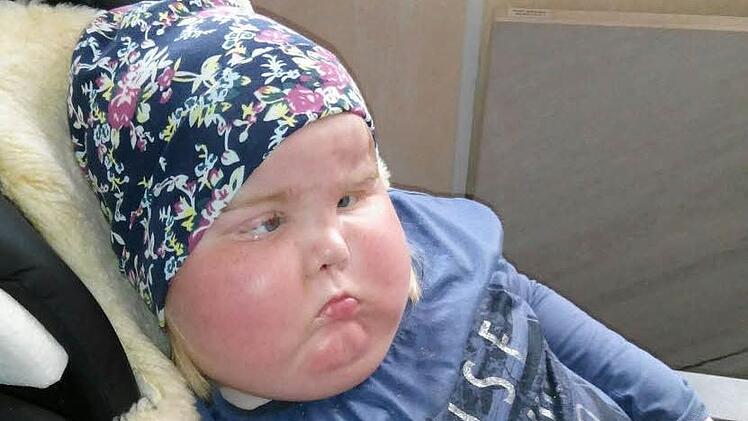 Heidi kurz vor ihrem Tod - vom Tumor gezeichnet.