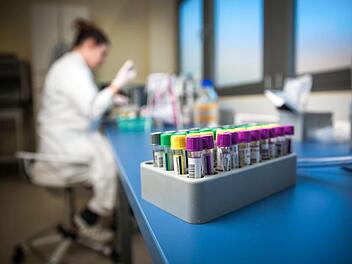 Mittlerweile sind 303 frühere Patienten der Entbindungsstation auf Tuberkulose getestet. Foto: imago/Sven Ellger