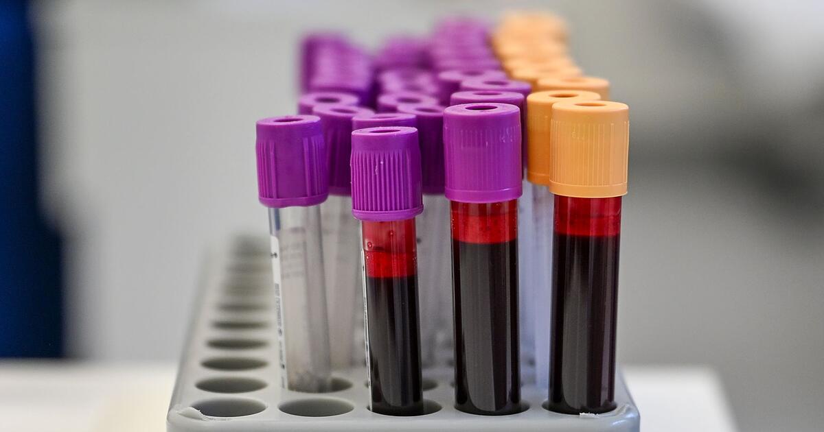 DRK-warnt-Deutschlandweit-fehlen-Blutspenden