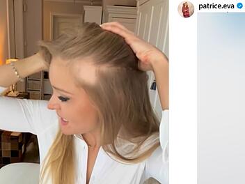 Patrice Aminati fallen jetzt die Haare aus - bewegende Message in Video