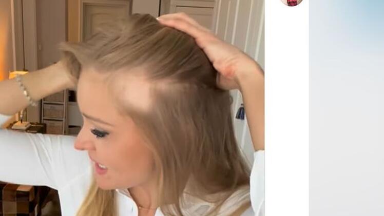 Krebskranker Patrice Aminati fallen jetzt die Haare aus: "Geht los"