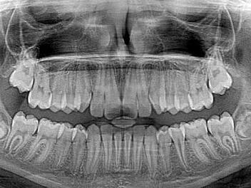 Vor 125 Jahren wurde die R&ouml;ntgenstrahlung in W&uuml;rzburg entdeckt. Sie gilt als gro&szlig;er und wichtiger Fortschritt in der Wissenschaft. Symbolfoto: jarmoluk/pixabay