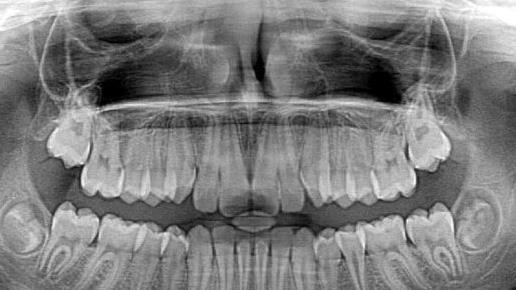 Vor 125 Jahren wurde die R&ouml;ntgenstrahlung in W&uuml;rzburg entdeckt. Sie gilt als gro&szlig;er und wichtiger Fortschritt in der Wissenschaft. Symbolfoto: jarmoluk/pixabay