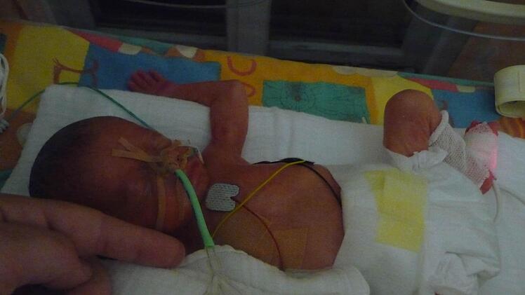 Der Kopf war kleiner als Mamas Zeigefinger: Matthias Till kam 13 Wochen zu früh auf die Welt. Danach gab es Komplikationen. Foto: privat