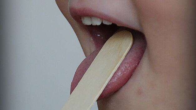 Bei Scharlach gen&uuml;gt oft eine Blickdiagnose.