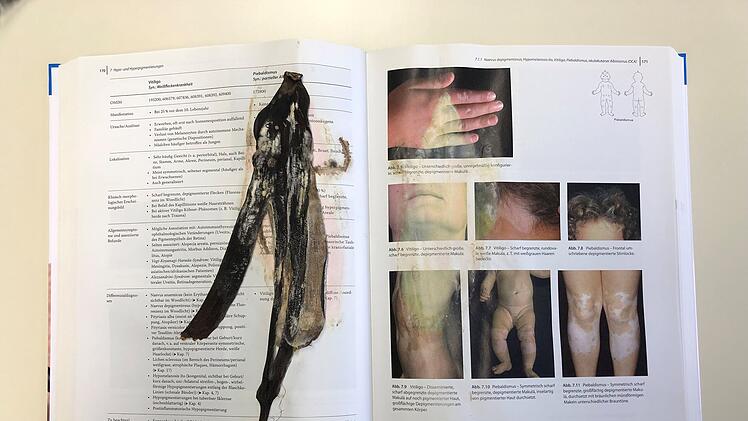 Erlangen: Mitarbeiter der Uni-Bibliothek machen ekelerregenden Fund in abgegebenem Buch