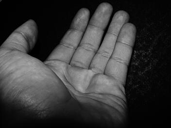 Betrüge auf Krücken