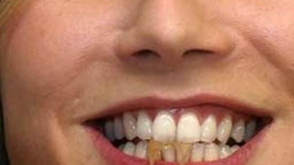 "Ich will nimma fasten, ich steh auf Piasten." So oder so ähnlich könnte der neue Werbeslogan für Heidi Klum lauten.  Foto: dpa