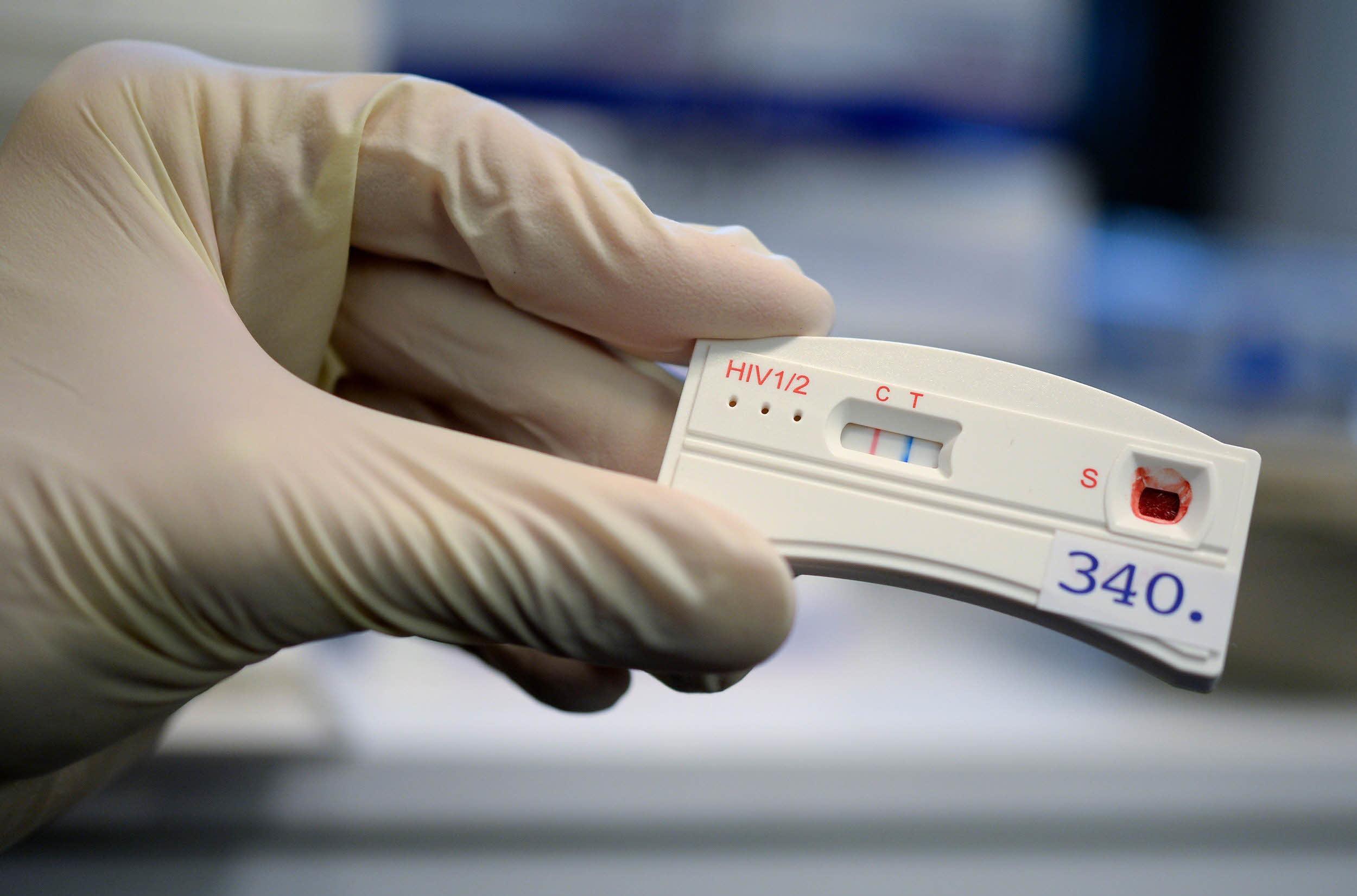 Meilenstein im Kampf gegen HIV und Aids Grünes Licht für HIV