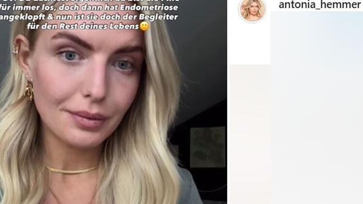 Oberfränkischer Realitystar macht chronische Krankheit öffentlich