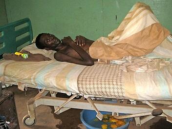 Ein unterernährter Patient bei Nzara im Südsudan.