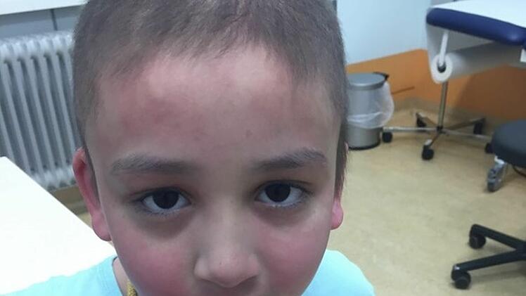 Nürnberg: Aurelia (6) kämpft gegen Krebs - "Bitte, lieber Gott, lass es gut ausgehen"