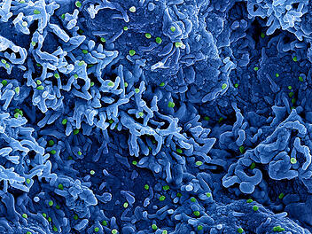 Erstmals Affenpocken bei Kleinkind