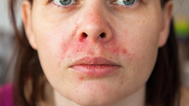Gesicht, Haut