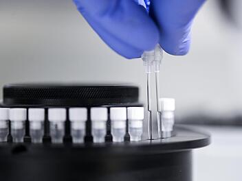 Foto: Felix K&auml;stle, dpa