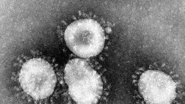 Der Coronavirus  - der Name der neuen tödlichen Lungenkrankheit aus Wuhan in China - breitet sich weiter aus. Die Weltgesundheitsorganisation (WHO) zeigt sich besorgt. Foto: Center for Disease Control/epa/dpa