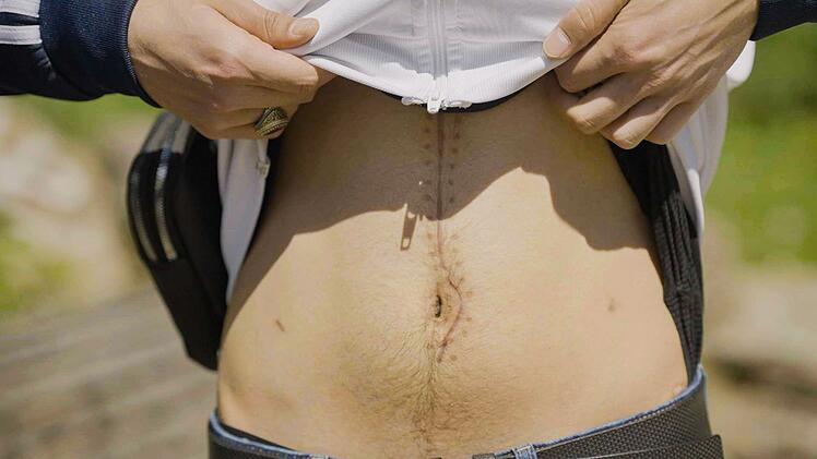 Der junge Syrer, der in Magdeburg schwer verletzt wurde, zeigt seine Narben.