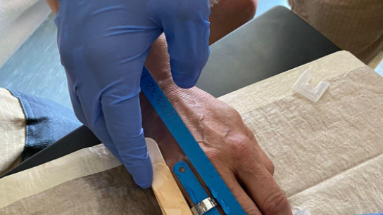 Bamberg: Chirurg ruft Feuerwehr um Hilfe - diese muss Frau von Fingerring befreien