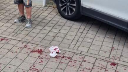 Bayreuth: Lokalpolitiker schildert rassistischen Angriff - "wie in schlechtem Hollywood-Film"