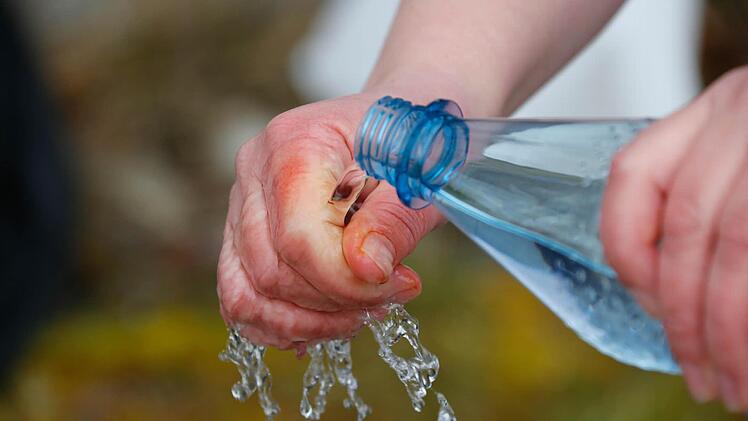 Bei Hautkontakt mit Wasser abspülen, lautet ein Warnhinweis auf der Spraydose. Spülen allein hilft nicht, wie sich zeigt. Nicht mal gründliches Waschen. Foto: Matthias Hoch