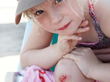 Aufgeschlagene Knie? Fr&uuml;her war das normal. Archiv/PR