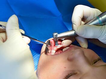 Loch im Zahn? Die EU-Kommission fordert, dass bei Zahnf&uuml;llungen f&uuml;r Kinder und Schwangere ab 2018 kein Amalgam mehr verwendet werden soll.  Foto: Patrick Pleul, dpa